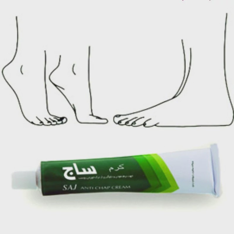 کرم رفع ترک پا و بدن ساج تاریخ جدید قیمت روی جلد 225000 تومن